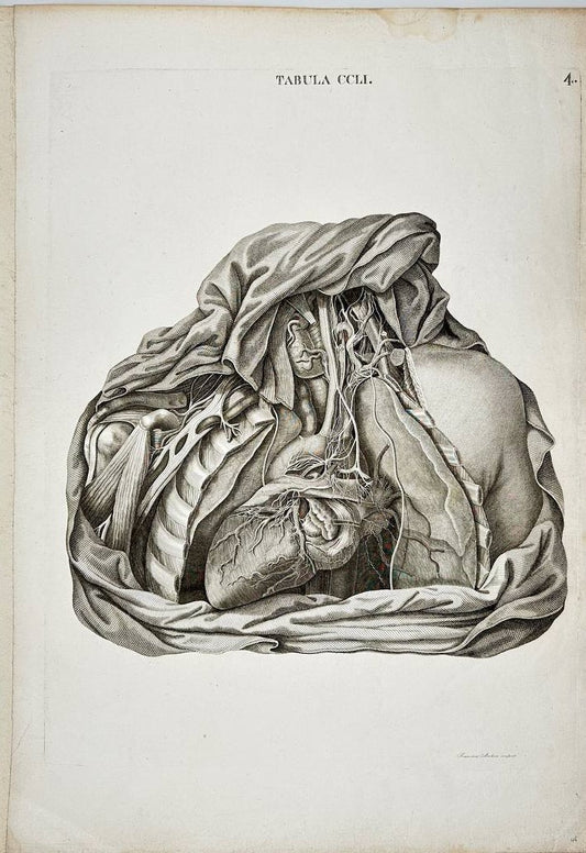 Rare Print - Pathology and Surgery of the Aorta - Icones Anatomicae - A. Caldani