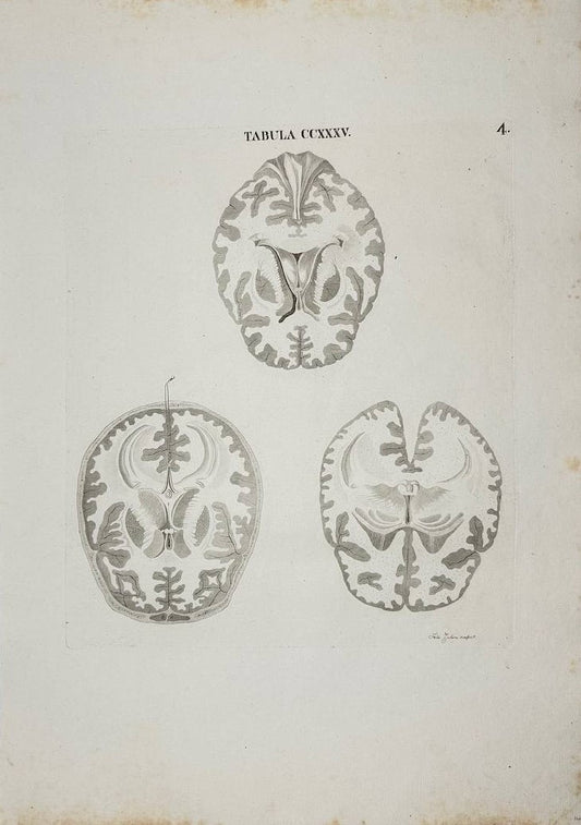 Antique Engraving - Human Brains - Anatomy - Icones Anatomicae - Antonio Caldani