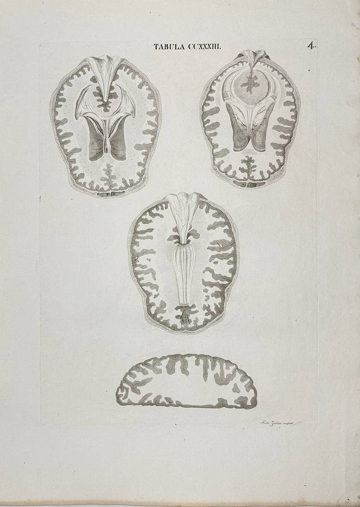 Antique Print - Human Brains - Anatomy and Physiology - Icones Anatomicae - 1813