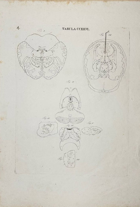 Rare Print - View from Inside the Skull - Icones Anatomicae - Brain - Caldani