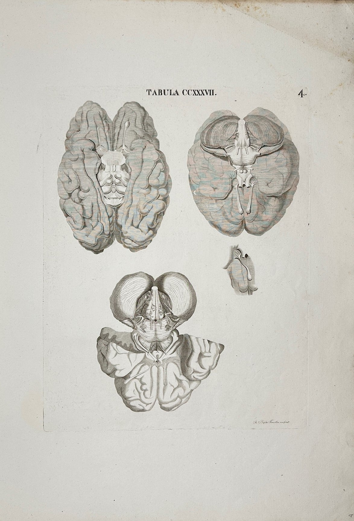 Rare Print - Anatomical Brain - Iconum Anatomicarum Explicatio - Antonio Caldani