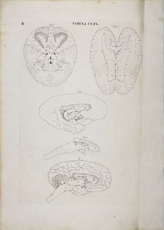 Antique Print - Human Brains - Anatomy - Icones Anatomicae - Antonio Caldani